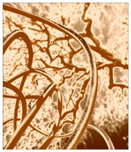 twist-(map)